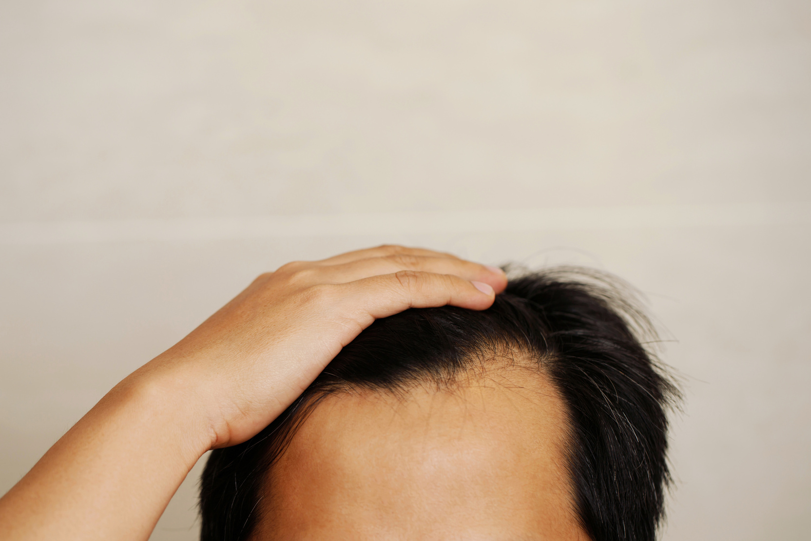 Bald men and gray hair are caused by stress.